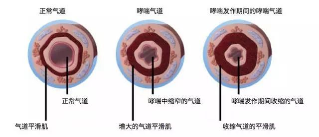 熱金屬?lài)娡糠蹓m污染